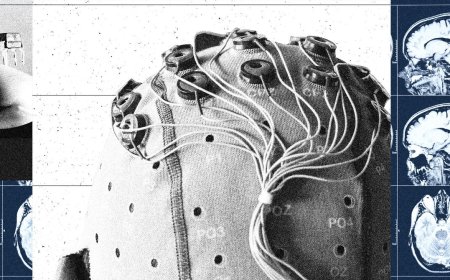 China Is Building a Brain-Computer Interface Industry