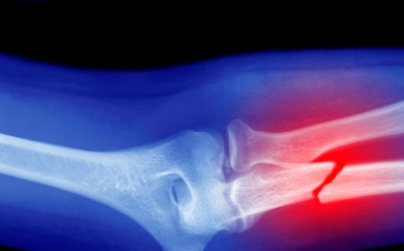 Microplastics Could Be Weakening Your Bones, Research Suggests