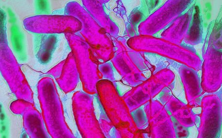 Resistant Bacteria Are Advancing Faster Than Antibiotics