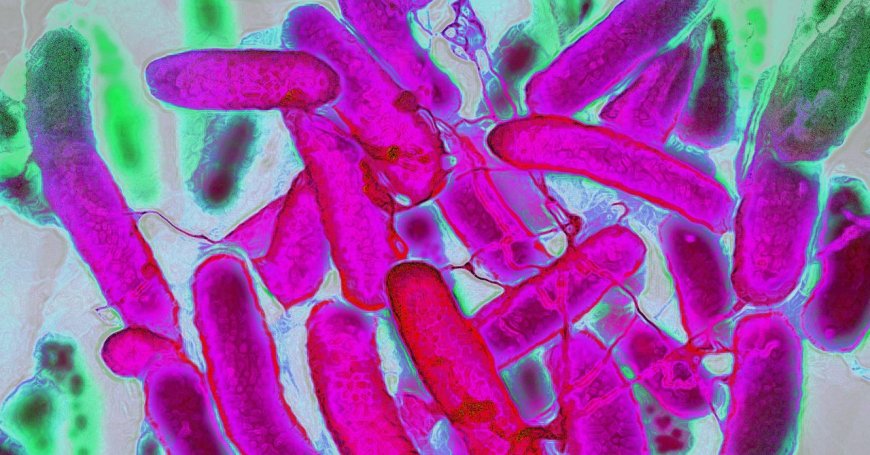 Resistant Bacteria Are Advancing Faster Than Antibiotics