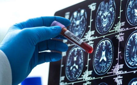 Blood Tests for Alzheimer’s Are Here