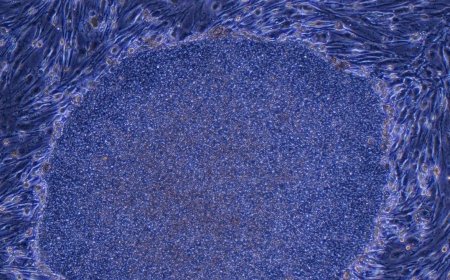 Japan Approves the World’s First Treatment Made With Reprogrammed Human Cells