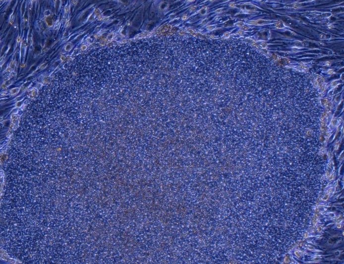 Japan Approves the World’s First Treatment Made With Reprogrammed Human Cells