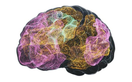 A Brain Implant for Depression Is About to Be Tested in Humans