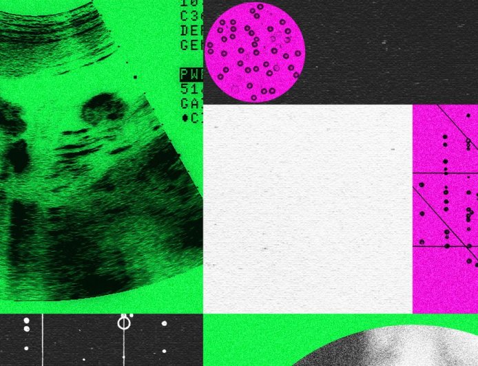 Designer Baby Companies Are in Turmoil