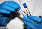 All Your Hantavirus Questions, Answered by an Infectious Disease Expert