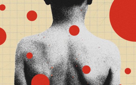 The Backward Logic of Chickenpox Parties