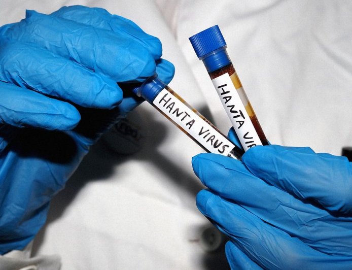 All Your Hantavirus Questions, Answered by an Infectious Disease Expert