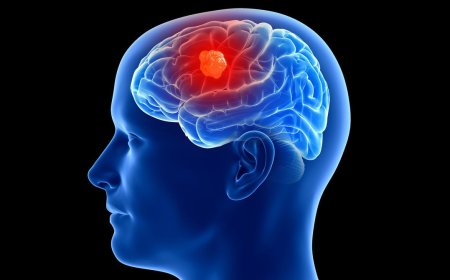 3 People Have Gotten Cancer-Detecting Implants in Their Brains